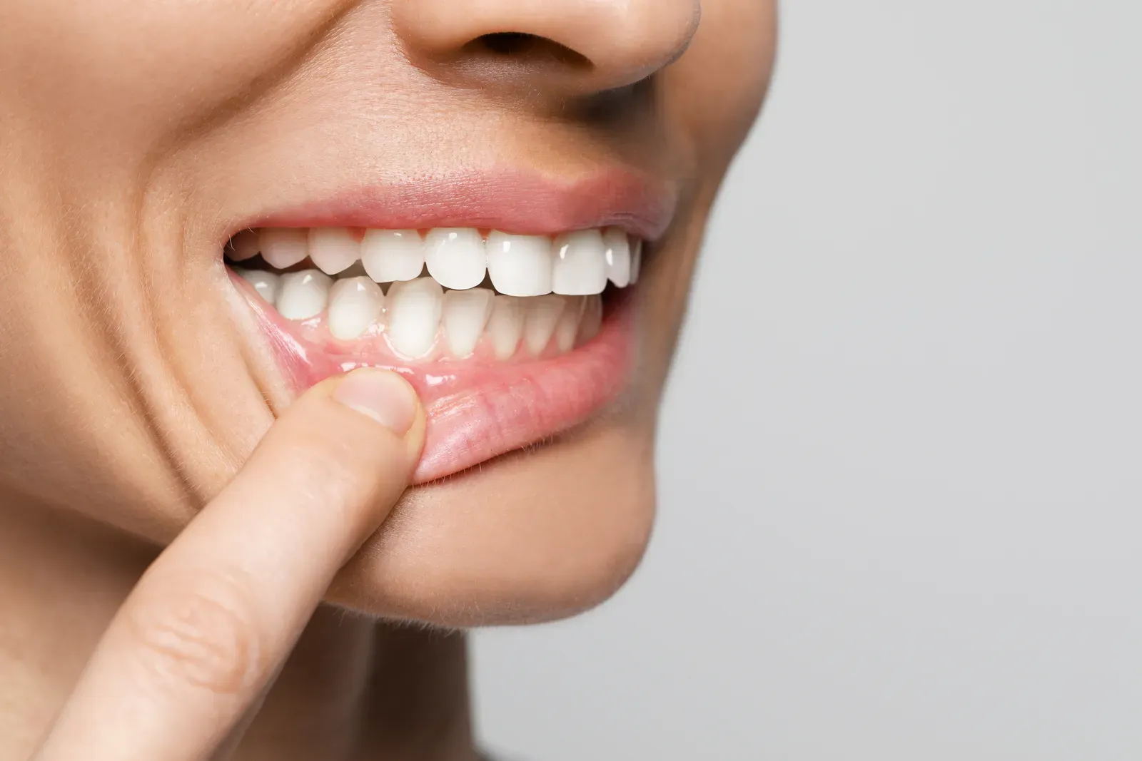 Gum Disease Treatment in Niles, IL | Smiles of Niles