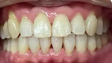 Smile after treatment